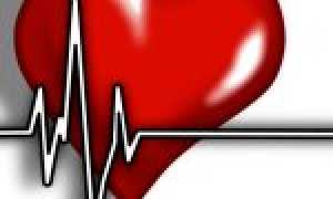 Синусовая брадикардия сердца – что это такое? Причины заболевания, симптомы и методы лечения