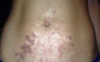 Лазерная, электро и фотоэпиляция. Что лучше? Тест-драйв. Часть 1