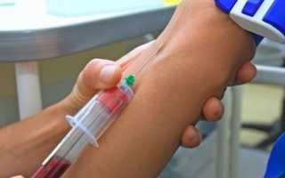 Причины повышенного и пониженного тестостерона у женщин