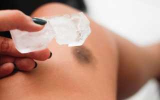 Не проходит синяк под глазом: причины и способы лечения