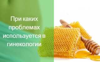 Лечебные свойства алоэ: чем может помочь растение?