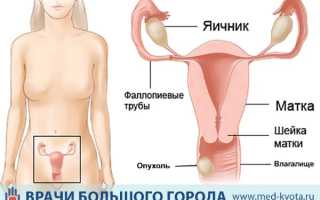 Рак влагалища: причины, виды и способы лечения