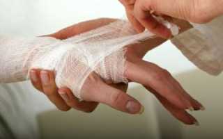 Что такое отморожение: виды, классификация и лечение