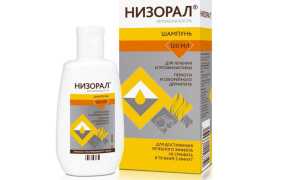 Как избавиться от перхоти в домашних условиях: лечение народными средствами