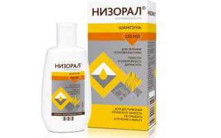 Как избавиться от перхоти в домашних условиях: лечение народными средствами