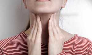 Симптомы и лечение мононуклеоза у детей по комаровскому