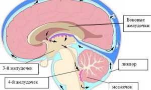 Что такое внутричерепное давление, как оно проявляется?