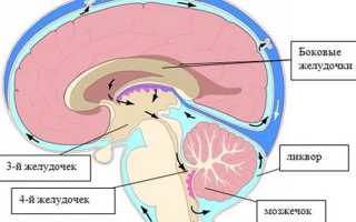 Что такое внутричерепное давление, как оно проявляется?