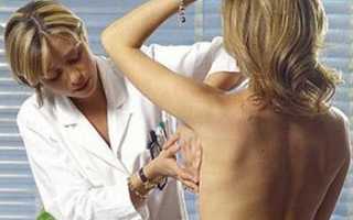 Боль в груди при беременности