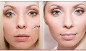 Маскирующие средства для лица — консилер и корректор