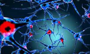 К вопросу о ботулинотерапии постинсультного спастического пареза: механизмы действия ботулотоксина, алгоритм восстановительного лечения