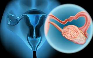 Причины резких и тянущих болей в левом яичнике