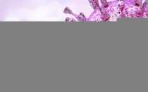 Цитомегаловирус igg антитела обнаружены что это значит?