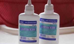 Как правильно полоскать горло хлоргексидином в т.ч. детям и беременным