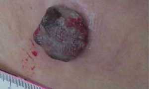 Кожные заболевания: фото и описание у взрослых с названиями