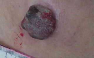 Кожные заболевания: фото и описание у взрослых с названиями