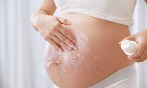 Растяжки во время беременности и после родов как избавиться