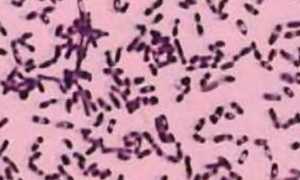 Иерсиниоз: как проявляется и лечится кишечная инфекция?