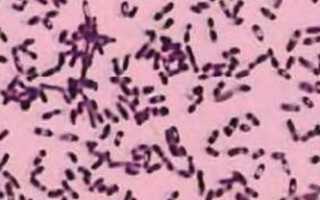 Иерсиниоз: как проявляется и лечится кишечная инфекция?