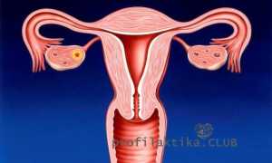 Очень скудные месячные 2 дня. Причины необильных (скудных) месячных
