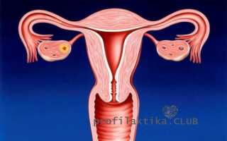 Очень скудные месячные 2 дня. Причины необильных (скудных) месячных