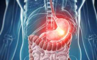 Все о гастрите с пониженной кислотностью — симптомы и способы лечения