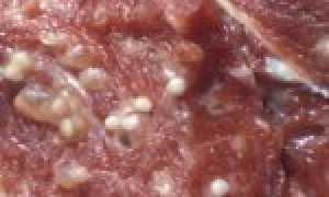 Как проявляется трихинеллез у человека и что служит причиной