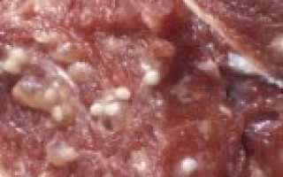 Как проявляется трихинеллез у человека и что служит причиной