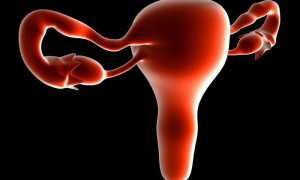 Как остановить кровотечение при месячных со сгустками