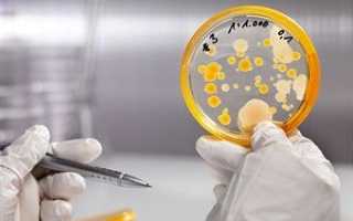 Признаки, по которым определяется дисбактериоз у женщин в гинекологии