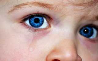 Аппендицит у ребенка: симптомы, диагностика, лечение. Признаки аппендицита у детей