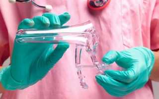 Очень скудные месячные причины после задержки. Скудные месячные после задержки: основные причины патологии