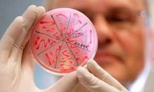 Что такое менингит — его признаки у детей и симптомы у взрослых