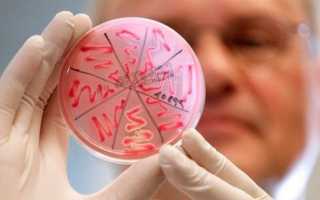 Что такое менингит — его признаки у детей и симптомы у взрослых