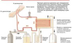 Сколько живут при диализе почек люди с почечной недостаточностью