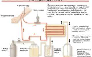 Сколько живут при диализе почек люди с почечной недостаточностью