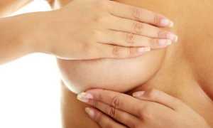 Причины, вызывающие выделения из грудных желез при надавливании