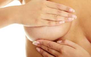 Причины, вызывающие выделения из грудных желез при надавливании