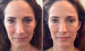 Скульптурный массаж лица: отзывы о технике против старения кожи