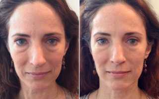 Скульптурный массаж лица: отзывы о технике против старения кожи