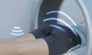 Магнитотерапия: виды, как проходит лечение, использование в домашних условиях