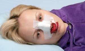 Проходят отеки после операции. Как снять отек после операции на лице