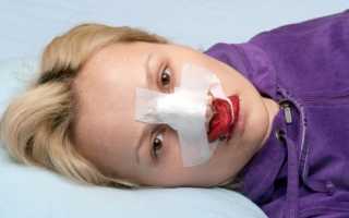 Проходят отеки после операции. Как снять отек после операции на лице