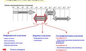 Чем закапать глаза после сварки в домашних условиях