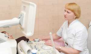 «Женский» рак: ранние симптомы рака яичников и рака шейки матки