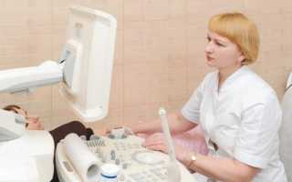 «Женский» рак: ранние симптомы рака яичников и рака шейки матки