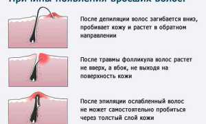 Как убрать усы у девушки в домашних условиях быстро