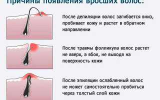 Как убрать усы у девушки в домашних условиях быстро