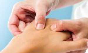 Синдром запястного канала (туннельный синдром): симптомы и лечение