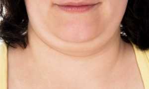 Как убрать второй подбородок: все возможные способы